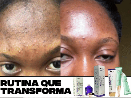 Serum 10 + Crema Limpiadora + Aclarante + 3 Mascarillas GRATIS